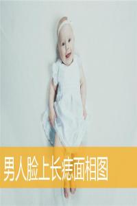 男人臉上長(zhǎng)痣面相圖