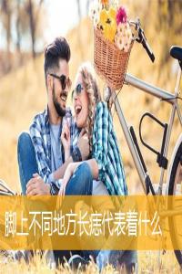 腳上不同地方長(zhǎng)痣代表著什么